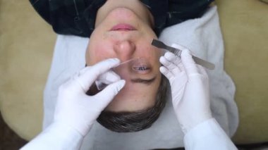 Bir dermatolog deri kazıması yaptırır ve deri iltihabı, mantar enfeksiyonu için testler yapar. Doktor randevusunda erkek bir hastanın yüzünü yakın plan çektir.