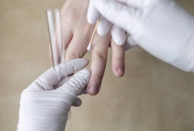 Dermatolog, pamuk çubuğu ve test tüpü kullanarak hastanın kolundan deri örneği topluyor. Mikrobiyolojik analiz. Deri hastalıklarının, mantarların ve enfeksiyonların teşhisi