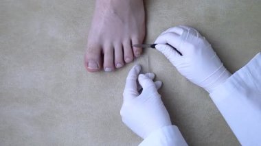 Bir ayak hastalıkları uzmanı mantar enfeksiyonunu incelemek için tırnağından örnek alır. Mikrobiyolojik inceleme, tırnak hastalığının tedavisi için örnek alma.