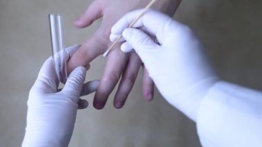 Dermatolog, pamuk çubuğu ve test tüpü kullanarak hastanın kolundan deri örneği topluyor. Mikrobiyolojik analiz. Deri hastalıklarının, mantarların ve enfeksiyonların teşhisi