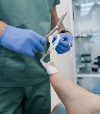 Tırnak kapağının çıkarılması, oyulmuş çivinin çıkarılması. Ameliyattan sonra ayak parmağından giyinmek. Onychocryptosis, paronychia ve irin hastalıklarının cerrahi tedavisi