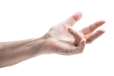 Dupuytren hastalığına yakalanmış yaşlı bir kadının eli. 