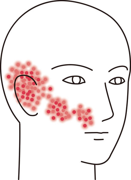 Иллюстрация черепицы на лице