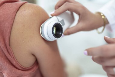 Dermatolog mol veya akne olan bir dermatoscope hastanın inceliyor. Melanom önleme