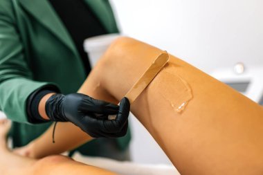 Güzellik uzmanı, lazer tüyü almak için müşterinin bacağına jöle sürüyor..