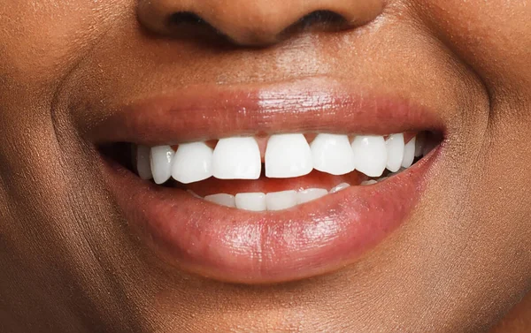 Sorriso Feminino Com Dentes Brancos Naturais Close — Fotografia de Stock