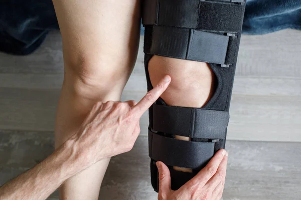 Female leg in orthosis knee brace. Damage to the internal ligaments of the knee joint in a patient. Doctor putting an orthosis on the injured knee