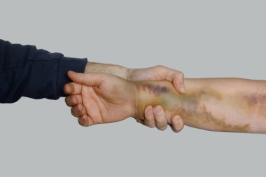 Erkek el, dişinin elini morluklarla tutar. Aile içi şiddet ve istismar kavramı. 