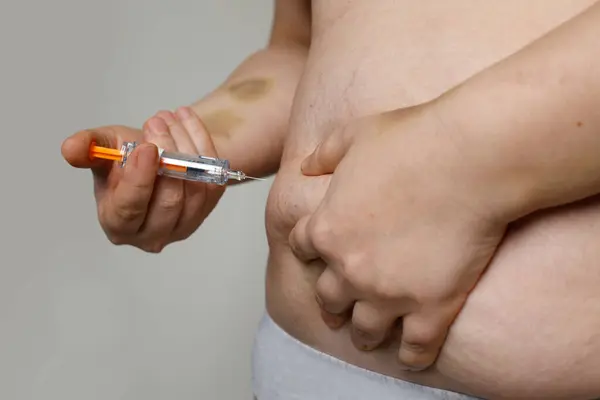 Femme Surpoids Appliquant Injection Médicament Dans Son Gros Plan Estomac — Photo