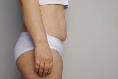 Kadın midesi, profil. Karnı şişmiş bir kadın. Aşırı kilolu, şişman, aşırı kilolu, diyet ve kilo kaybı kavramı