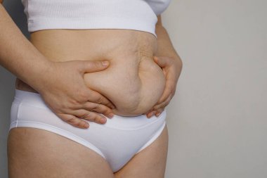 Kadın elleri karnını şişirerek yakın plan çekiyor. Aşırı kilolu, şişman, aşırı kilolu, diyet ve kilo kaybı kavramı