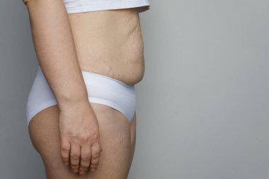 Çizgili ve kilolu bir kadın, profili yakın.