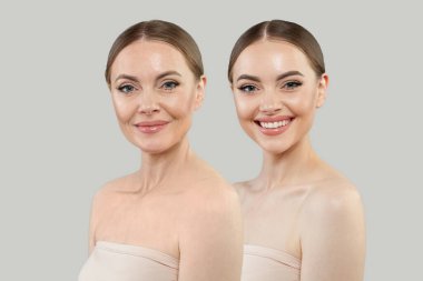 Beyaz arka planda mükemmel kadınlar. Genç ve olgun bir kadın model. Yüz tedavisi, kozmetoloji, tıp, cerrahi ve gençleştirme kavramı