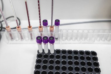 İlaç fabrikasının modern laboratuarında analiz için test tüpünden numune. Kalite kontrolü sağlanıyor