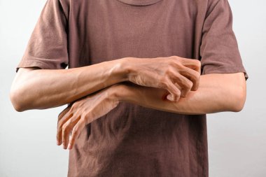 Kolunu kaşıyan bir adamın portresi beyaz bir arka planda izole edilmiş. Kaşındıran kaşıntılar. Sağlık hizmetleri kavramı