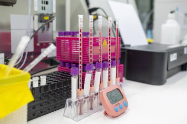 İlaç fabrikasının modern laboratuarında analiz için test tüpünden numune. Kalite kontrolü sağlanıyor