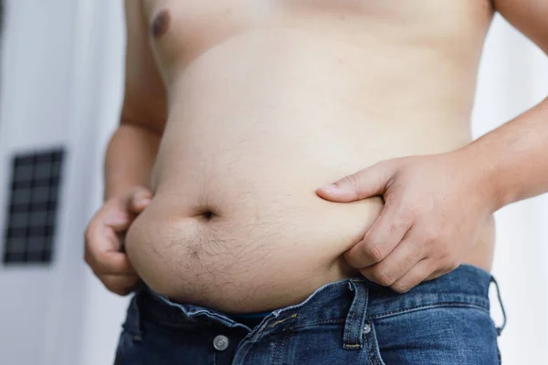 Mann Mit Dickem Bauch Diätkonzept Übergewichtiger Mann Berührt Seinen Dicken lizenzfreie Stockfotos