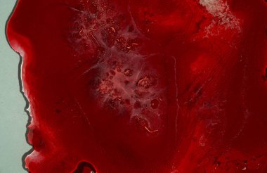 Kimyasal laboratuvar analizi yakın plan. Düz bir tıbbi kan analizi konsepti. Kimyasal laboratuvar analizi. Tıbbi kan testi, kan örnekleri. Yüksek kalite fotoğraf