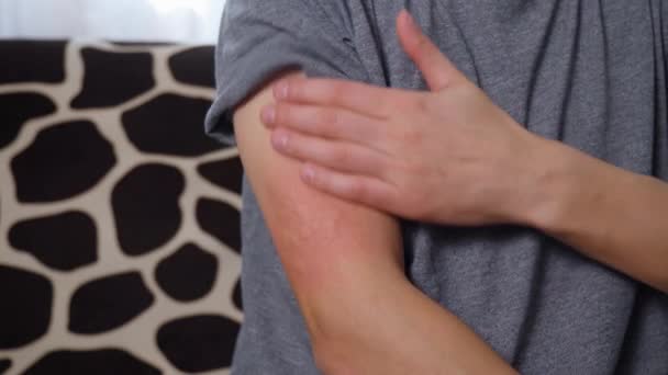 アレルギーからの注射後の人間の腕の中でのワクチン反応 腫れた部分 赤い穿刺部位 誰も知らない — ストック動画