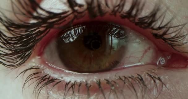 茶色の虹彩で目の開口部のクローズアップ すべてのコンピュータでの長い仕事から炎症を起こしたタンパク質と赤 不健康なビジョンの概念 4Kの前のマクロビデオ — ストック動画