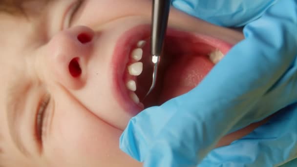 Kind Mit Offenem Mund Aus Nächster Nähe Beim Zahnarzt Zahnarzt — Stockvideo