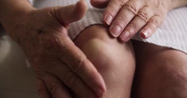 Popliteal ya da sinovial kisti olan bir emekli, dizinin arkasında sıvı dolu bir şişlik. Popliteal kist, hasarlı diz ekleminden sıvı.