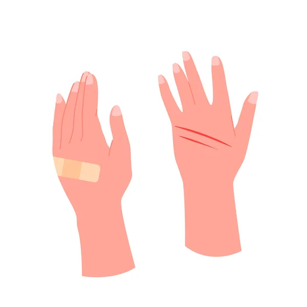 Sebesült Emberi Kéz Sebtapasszal Sebinfografikus Vektor Illusztrációval Rajzfilm Izolált Két — Stock Vector