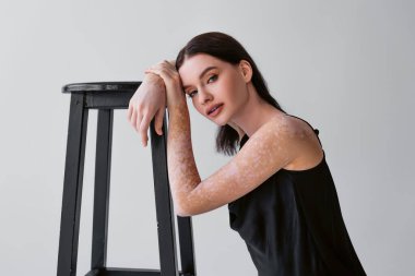 Vitiligo 'su olan güzel esmer kadın gri sandalyenin yanında poz veriyor. 