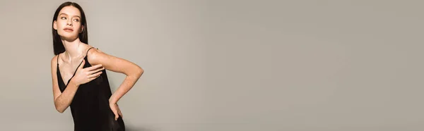 Mladý Model Vitiligo Pózování Černých Šatech Šedém Pozadí Banner — Stock fotografie