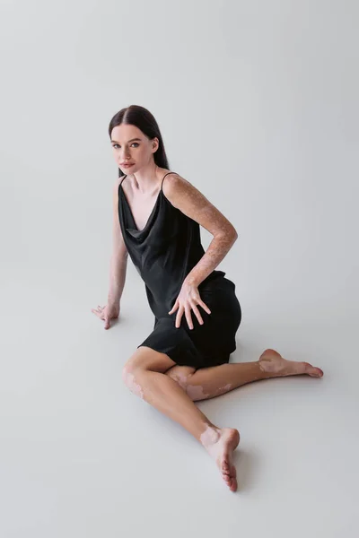 Pretty Woman Vitiligo Posing Satin Dress While Sitting Grey Background — Stock Photo, Image