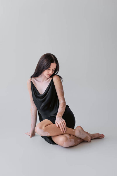Pretty woman with vitiligo touching leg while sitting on grey background 