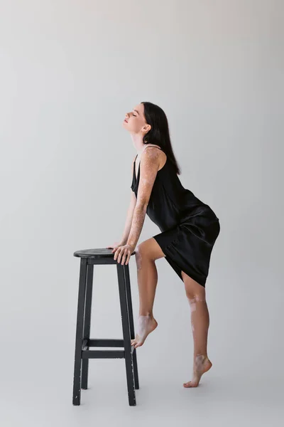 Boční Pohled Mladý Model Vitiligo Pózování Blízkosti Židle Šedém Pozadí — Stock fotografie