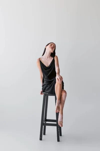 Mulher Satisfeita Com Vitiligo Cruzando Pernas Enquanto Sentado Cadeira Fundo — Fotografia de Stock