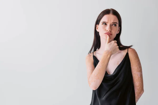 Mujer Pensativa Con Vitiligo Tocando Labio Aislado Gris —  Fotos de Stock