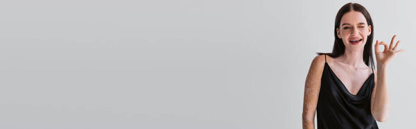 Pretty model with vitiligo showing okay gesture at camera isolated on grey, banner 