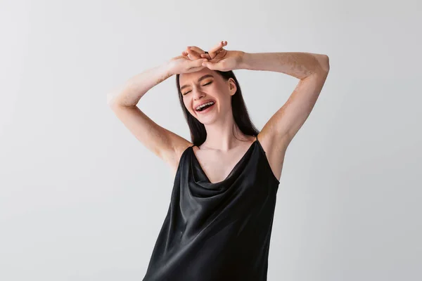 Glada Kvinna Med Vitiligo Blundar Samtidigt Poserar Isolerad Grå — Stockfoto