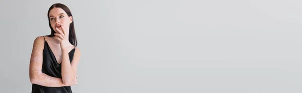 Fiatal Modell Vitiligo Megható Ajkak Elszigetelt Szürke Banner — Stock Fotó