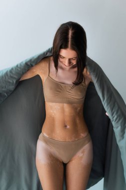 Vitiligo cilt hastalığı olan genç bir kadın. İç çamaşırlarıyla dikiliyor ve gri üzerine battaniye örtüyor. 
