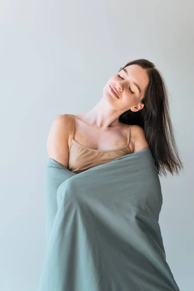 灰色で隔絶された毛布に覆われた状態の白斑肌の明るい女性 — ストック写真