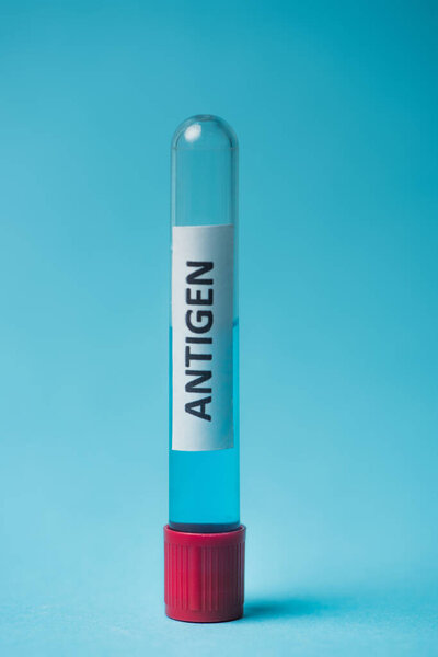 Close up view of test tube with antigen lettering on blue background 