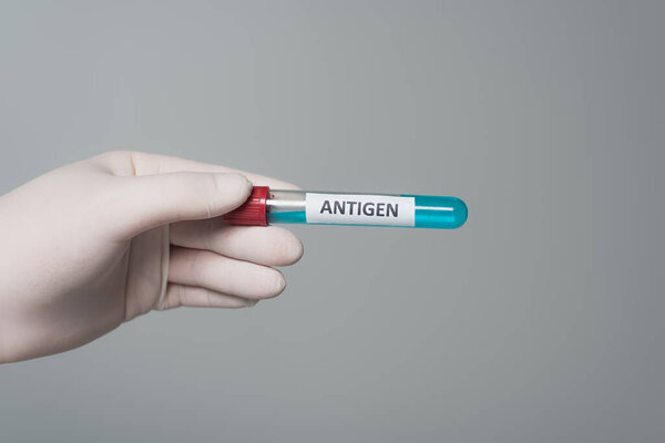 Cropped view of doctor in latex glove holding test tube with antigen lettering isolated on grey 