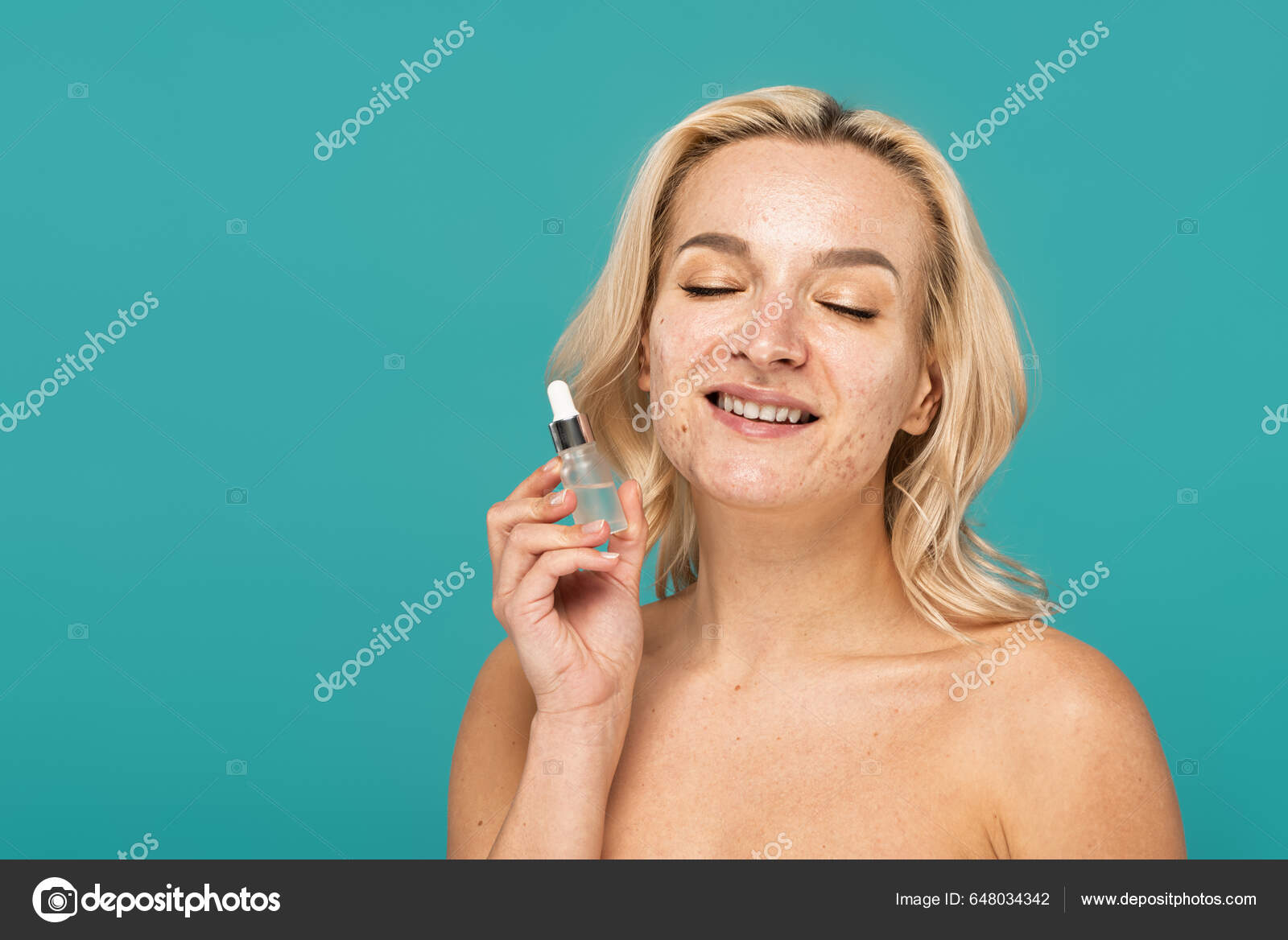 cheerful-woman-acne-face-holding-bottle-serum-isolated-turquoise-stock