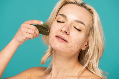 blonde woman with acne massaging face with jade face scraper isolated on turquoise clipart