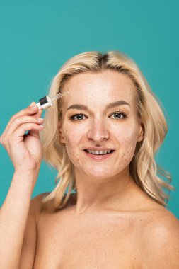 Yüzünde sivilce olan mutlu bir kadın elinde serumla turkuazda izole edilmiş bir pipet tutuyor.