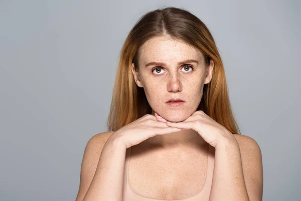 Ung Kvinna Med Pigmentering Huden Tittar Kameran Isolerad Grå — Stockfoto