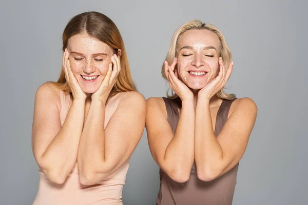 Lächelnde Interrassische Frauen Mit Problemhaut Berühren Gesicht Isoliert Auf Grau — Stockfoto