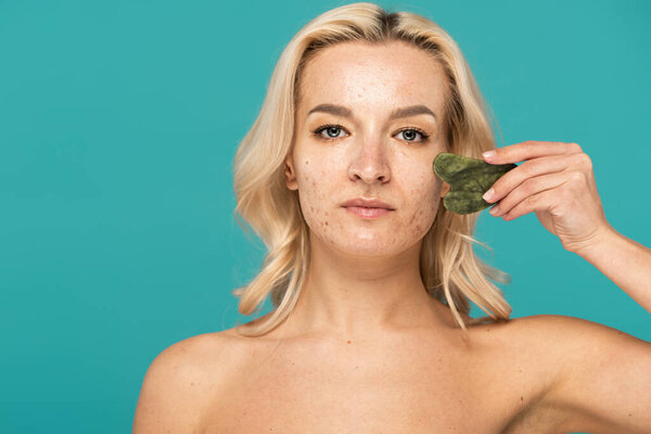 blonde woman with adult acne massaging face with jade face scraper isolated on turquoise