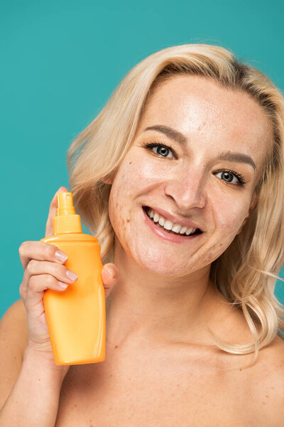 happy woman with adult acne holding bottle with sunscreen isolated on turquoise