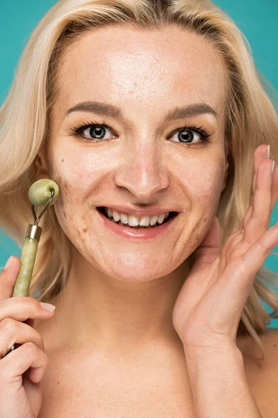 Close Cheerful Blonde Woman Acne Holding Jade Roller Isolated Turquoise — Stock Photo, Image