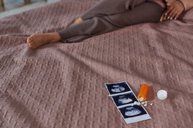 birth control pills near ultrasound photo, african american woman on bed, making decision, cropped clipart